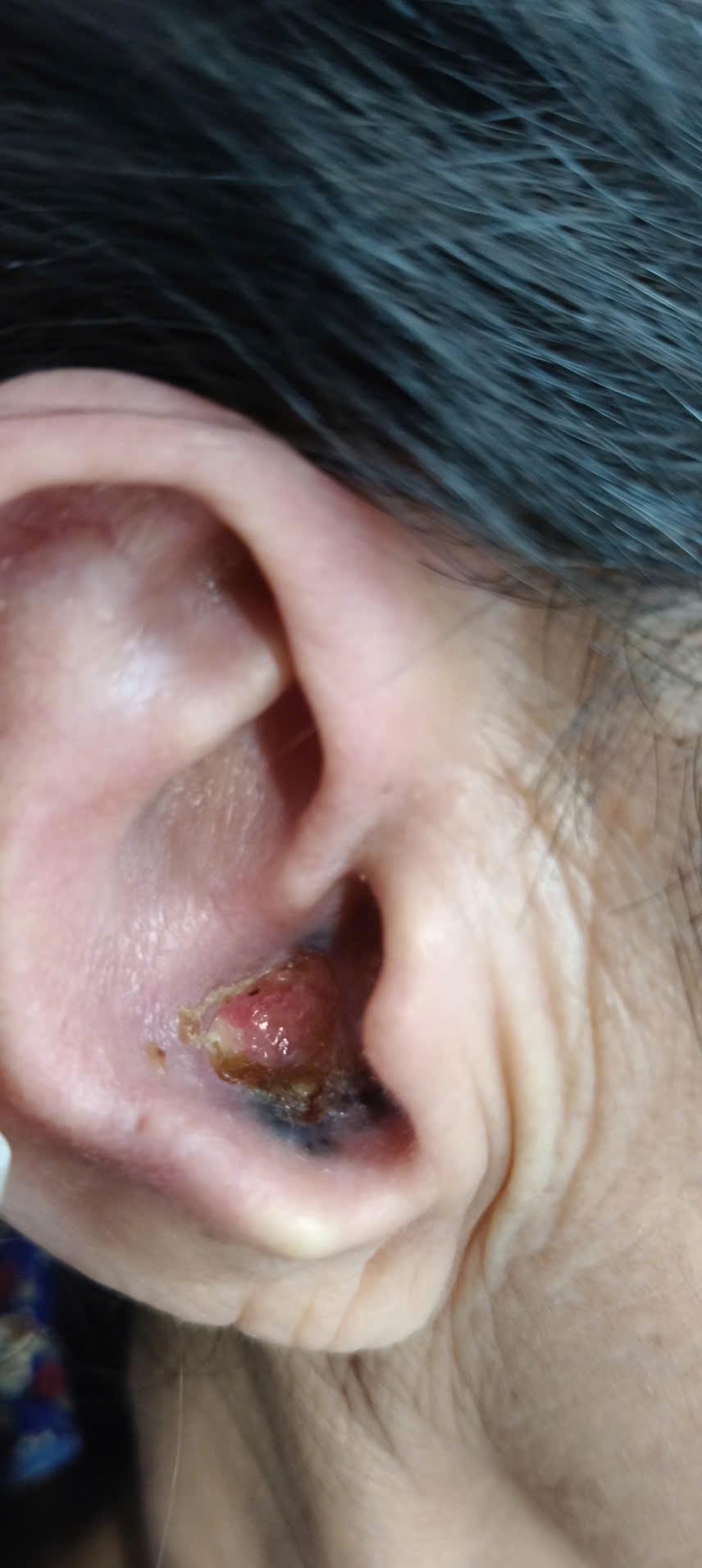 2423681635142056726-3